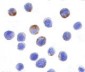 DDX3 Antibody
