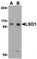 LSD1 Antibody