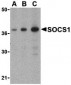 SOCS1 Antibody
