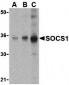 SOCS1 Antibody