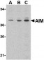 AIM Antibody