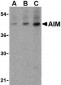 AIM Antibody