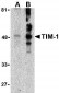 TIM-1 Antibody
