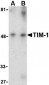 TIM-1 Antibody