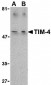 TIM-4 Antibody