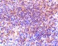 PAK2 Antibody