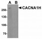 TRPC6 Antibody