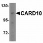 TRPC6 Antibody