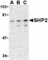 SHP2 Antibody