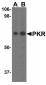 PKR Antibody