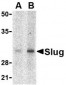 Slug Antibody