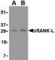 sRANK Ligand Antibody