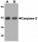 Nicastrin Antibody