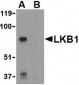 LKB1 Antibody