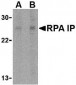 RPA Interacting Protein Antibody