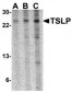 TSLP Antibody