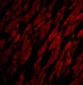 CRTH2 Antibody