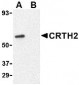 CRTH2 Antibody