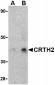 CRTH2 Antibody