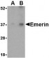 Emerin Antibody