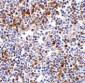 MDA5 Antibody