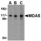 MDA5 Antibody