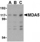 MDA5 Antibody