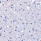 TIGAR Antibody