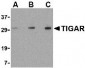 TIGAR Antibody