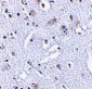 TIGAR Antibody