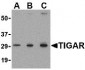 TIGAR Antibody