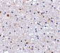 PD-1 Antibody