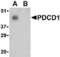 PD-1 Antibody