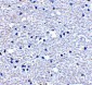 PD-1 Antibody