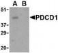 PD-1 Antibody