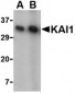 KAI1 Antibody