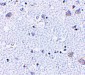 BRSK1 Antibody