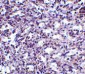 STIM2 Antibody