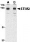 STIM2 Antibody