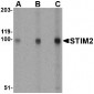 STIM2 Antibody