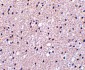 Presenilin1 Antibody