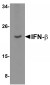 IFN-beta Antibody