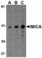 MICA Antibody