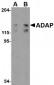ADAP Antibody