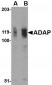 ADAP Antibody