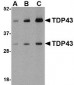 TDP43 Antibody