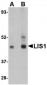 LIS1 Antibody