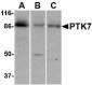 PTK7 Antibody