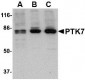 PTK7 Antibody