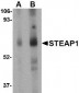 STEAP1 Antibody